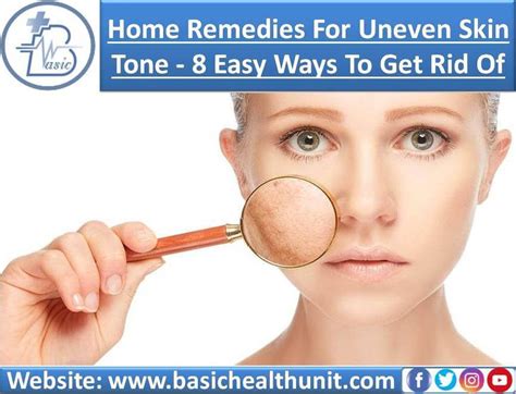Home Remedies For Uneven Skin Tone 8 Ways To Get Rid Of It