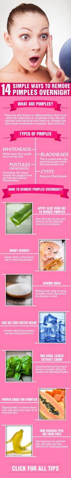 14 Simple Ways To Get Rid Of Pimples Overnightfast And Safe How To