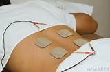 Pictures of Neuromuscular Electrical Stimulation