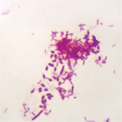 Pseudomonas Aeruginosa Wm Microscope Slide Industrial