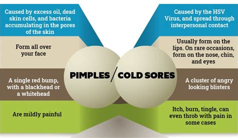 Cold Sore Vs Pimple Differences Symptoms And Treatment Be