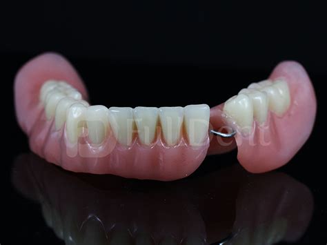 We did not find results for: Removable Prosthetics - FullDent