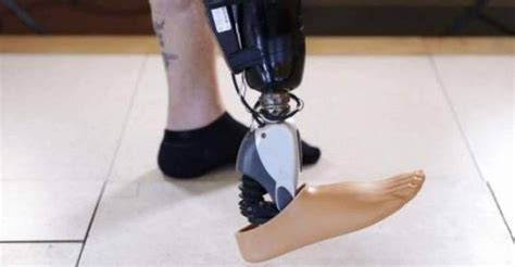Proteza Stopy Sterowana My Lami To Dzia A Prosthetic Leg Biomedical