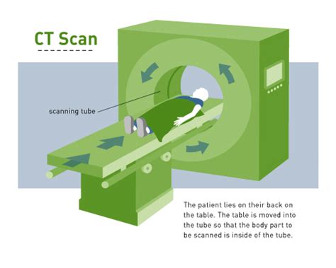 Ct Scan Cat Curesearch