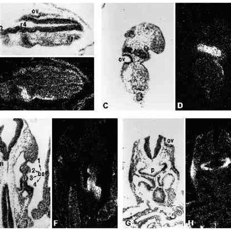 Expression Of C Ret MRNA In The Trigeminal And The Dorsal Root Ganglia