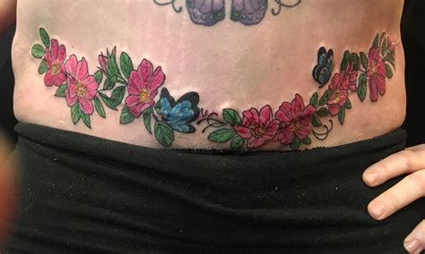Gemstone Tattoo Abdomen Scar Cover Up