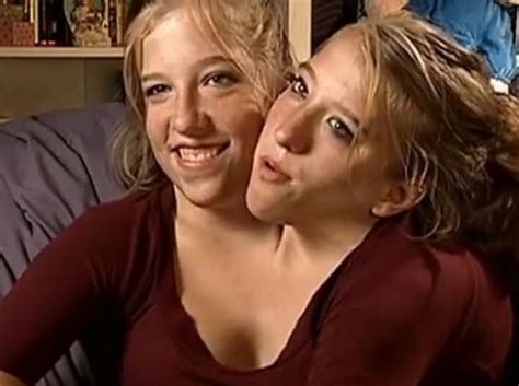 Stream tracks and playlists from siamese twins records on your desktop or mobile device. Difference Between Conjoined Twins And Siamese Twins - Hosbeg.com