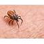 Lyme Disease Symptoms Causes & Diagnosis  Goop