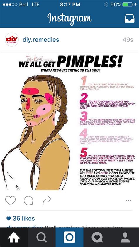Pimple Chart Pimples Beauty Skin Care Pimple Chart