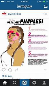 Pimple Chart Pimples Pimple Chart Skin Care Acne