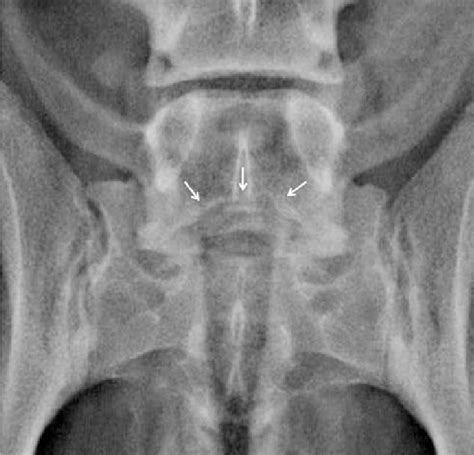 ventrodorsal pelvic radiograph a radiolucent and irregular defect of download scientific