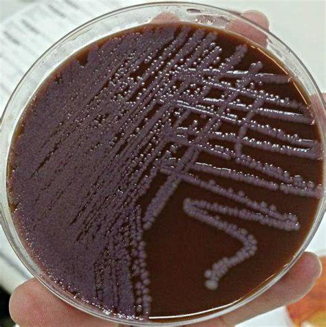 Serratia Marcescens On Chocolate Agar Microbe Notes