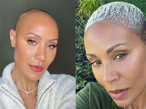 Jada Pinkett Smiths Alopecia Journey The Star Shares An Update