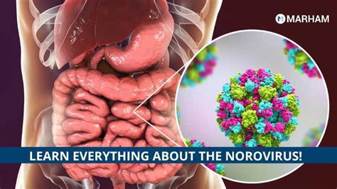 Is There A Stomach Bug Going Around The Deadly Norovirus 2022 Marham