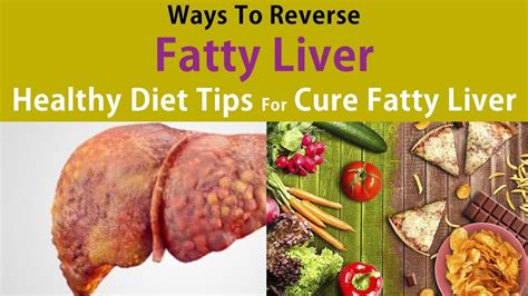 Ways To Reverse A Fatty Liver Healthy Diet Tips For Cure Fatty Liver