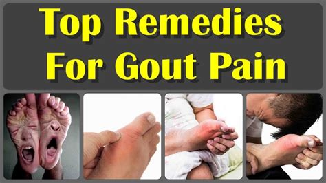 How To Cure Gout Naturally In 24 Hours And 10 Top Home Remedies For