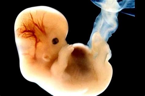 Desarrollo Embrionario Y Fetal Timeline Timetoast Timelines The