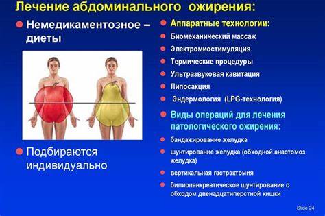 Диета При Морбидное Ожирение — Похудение Диета Правильное Питание Картинка - Диета При Морбидное Ожирение — Похудение Диета Правильное Питание