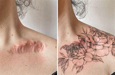 16 Iconic Transformations Of Scars Into Beautiful Tattoos