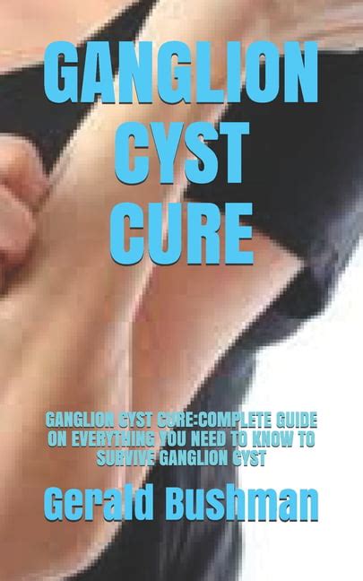 Ganglion Cyst Cure Ganglion Cyst Cure Complete Guide On Everything