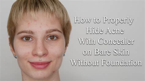 How To Properly Hide Acne With Concealer On Bare Skin Without