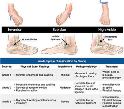 Ankle Sprain And Rehabilitation Health Associates