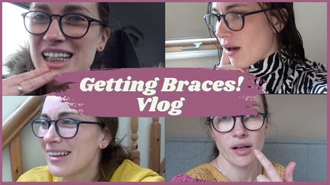 Getting Adult Braces Vlog Youtube