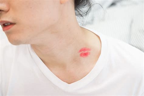 top easy ways of how to get rid of hickeys healthyell