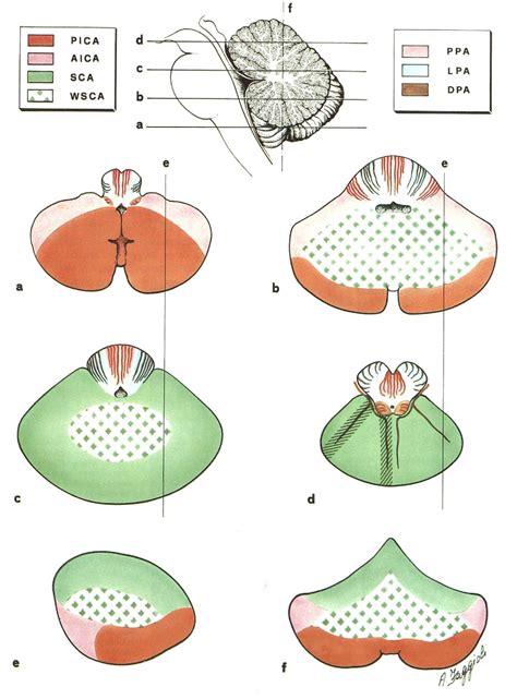 Figure 4 From The Vascular Territories In The Cerebellum And Brainstem