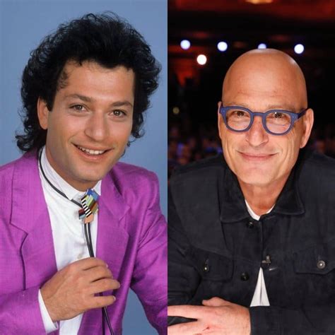 Did Howie Mandel Ever Have Hair Why Is He Bald