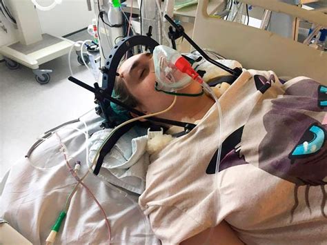 Girl 18 Is Paralysed For Life After Snapping Her Neck When She Fell