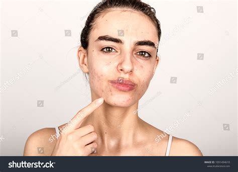 1105 Spot Face Boys And Girls Images Stock Photos And Vectors