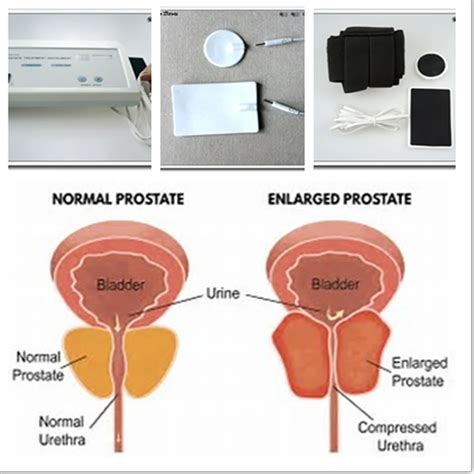 japanese prostate massage telegraph