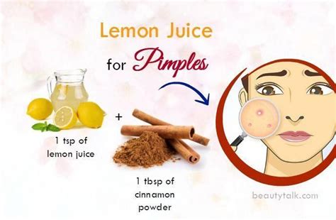 Top 39 Natural Home Remedies For Pimples On Face And Body Do They