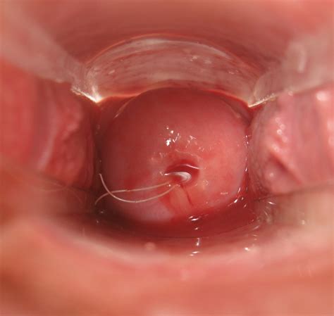 Ejaculation Inside Vagina Sex Gifs IgFAP