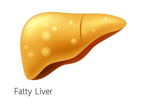 Fatty Liver Disease Rash Herbs And Food Recipes