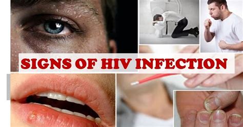 5 Common Hiv Symptoms In Men Ladies See How To Know If Hes Hiv
