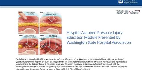 Hospital Acquired Pressure Injury Education Module Presented