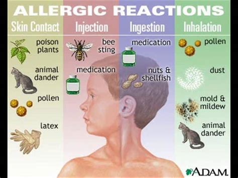 Herbal Remedies For Allergies Natural Antihistamines Remedygrove