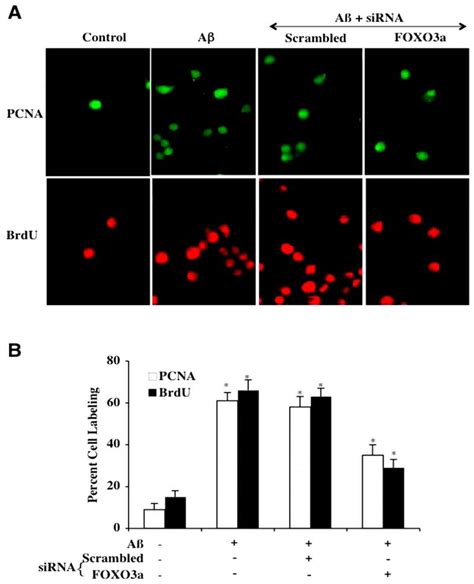 Transfection With FoxO3a SiRNA Prevents Early Microglial Activation And