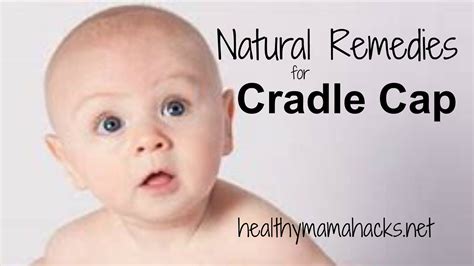 11 Natural Remedies For Cradle Cap Healthy Mama Hacks