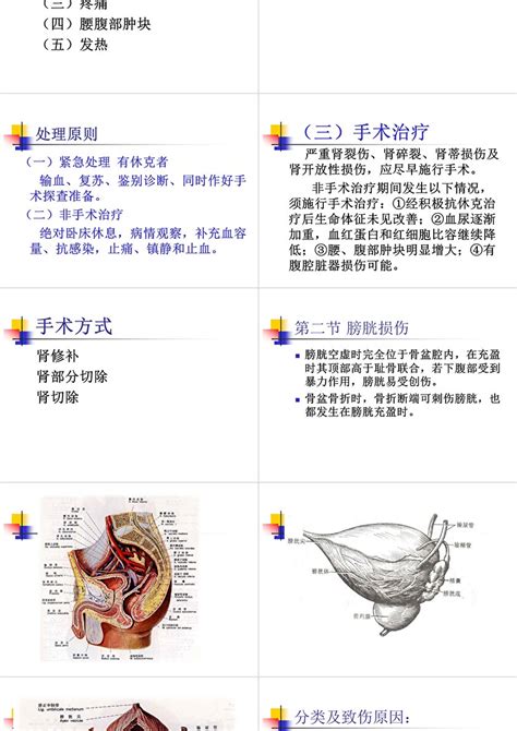 外科护理学泌尿系统损伤病人的护理ppt模板卡卡办公