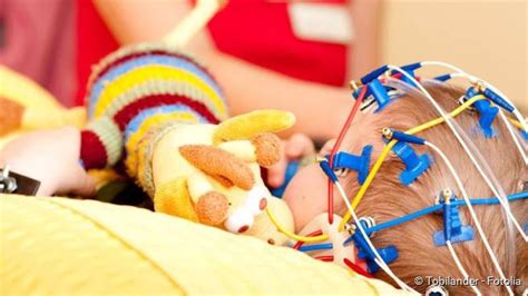 Epilepsie Bei Kindern Anfallsarten Prognose Netdoktorat