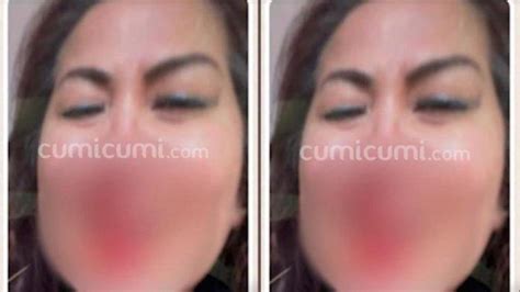 Beredar Foto Venna Melinda Menangis Dengan Wajah Sudah Berlumuran Darah Akibat Kdrt Suami