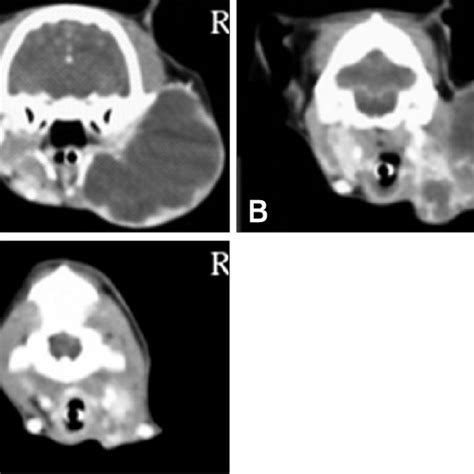 Post Contrast Ct Images Showing Enlargement Of The Right Submandibular