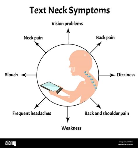 Symptoms Of Text Neck Syndrome Spinal Curvature Kyphosis Lordosis Of