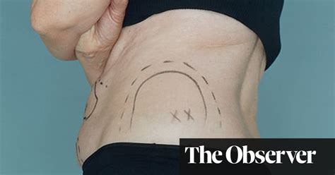 Plastic Surgery Companies Under Fire For Tempting People Into Unneeded