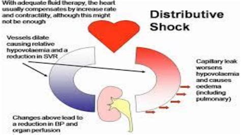 Understanding Distributive Shock Medmaximizerunderstanding