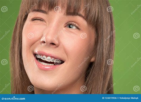 Beautiful Young Woman With Teeth Braces Stock Photo Image Of Beauty