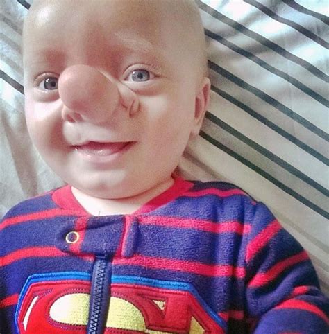 Baby Ollie Is A Real Life Pinocchio Says Proud Mum Uk News
